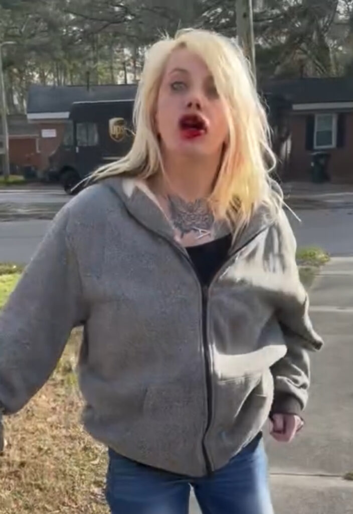 Ashley Davis of Wilson busted lip