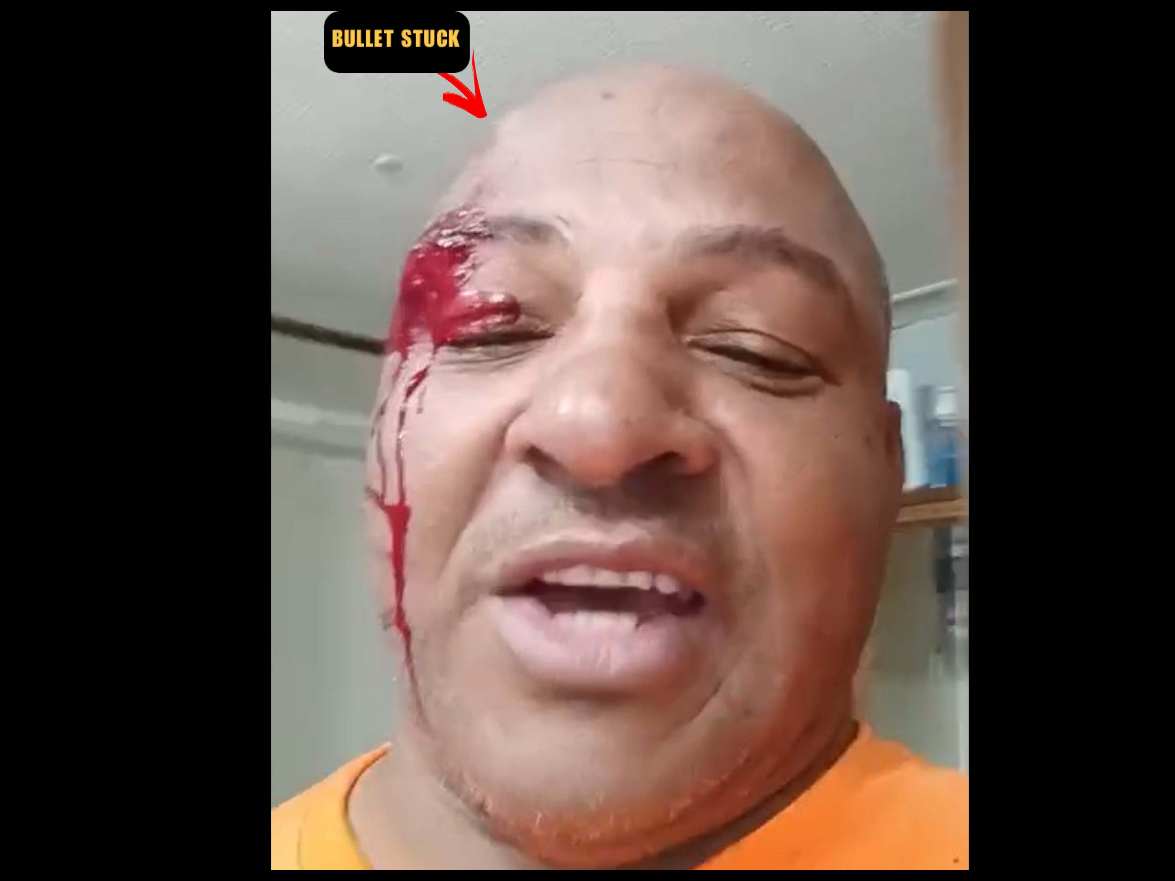 North Carolina man shot in face