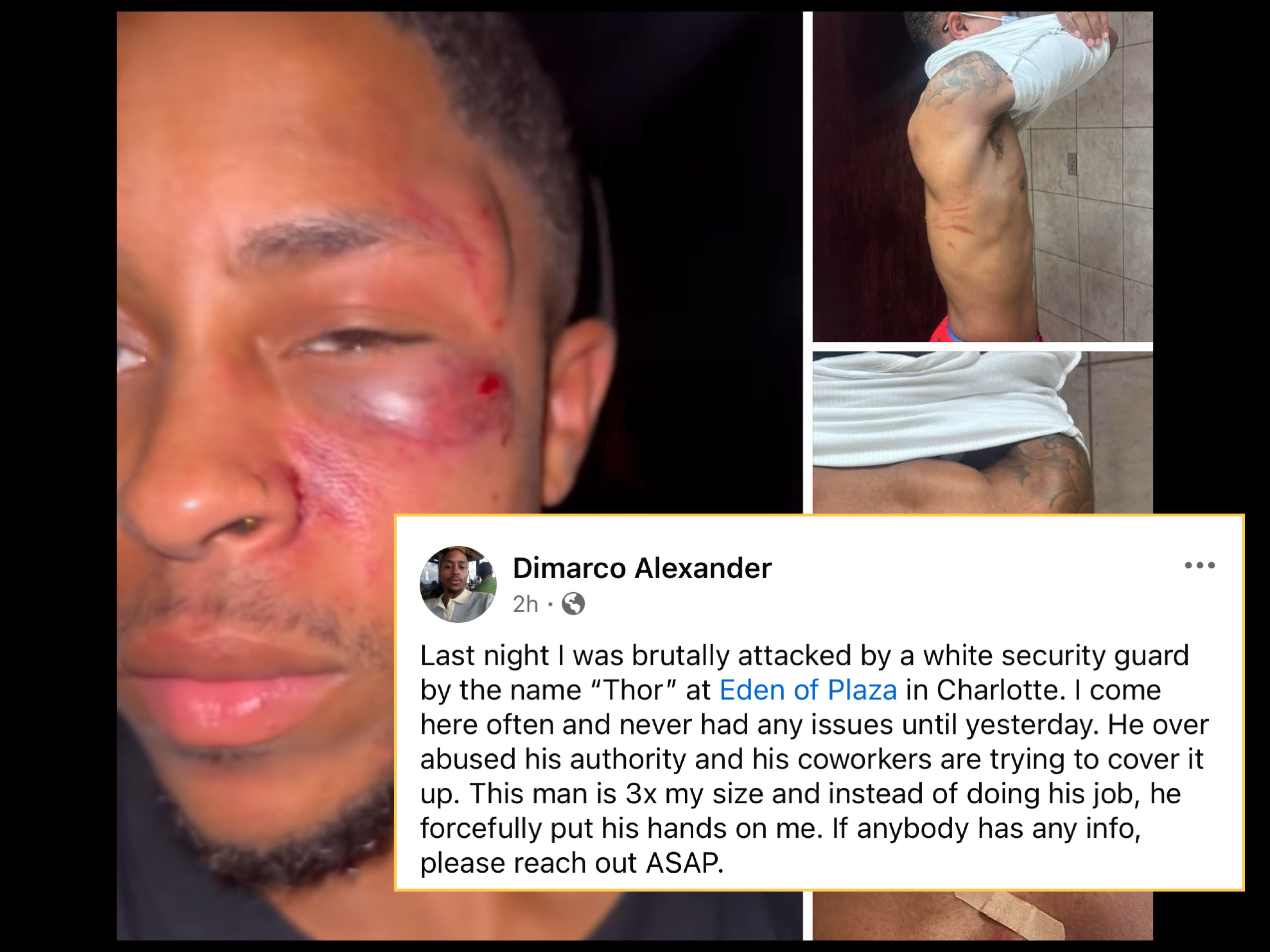 North Carolina man injured in alleged Eden of Plaza assault incident