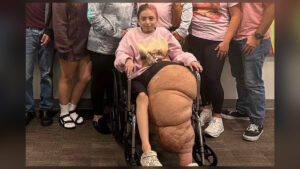 Florida teen rings victory bell after surviving rare leg condition and life-saving amputation