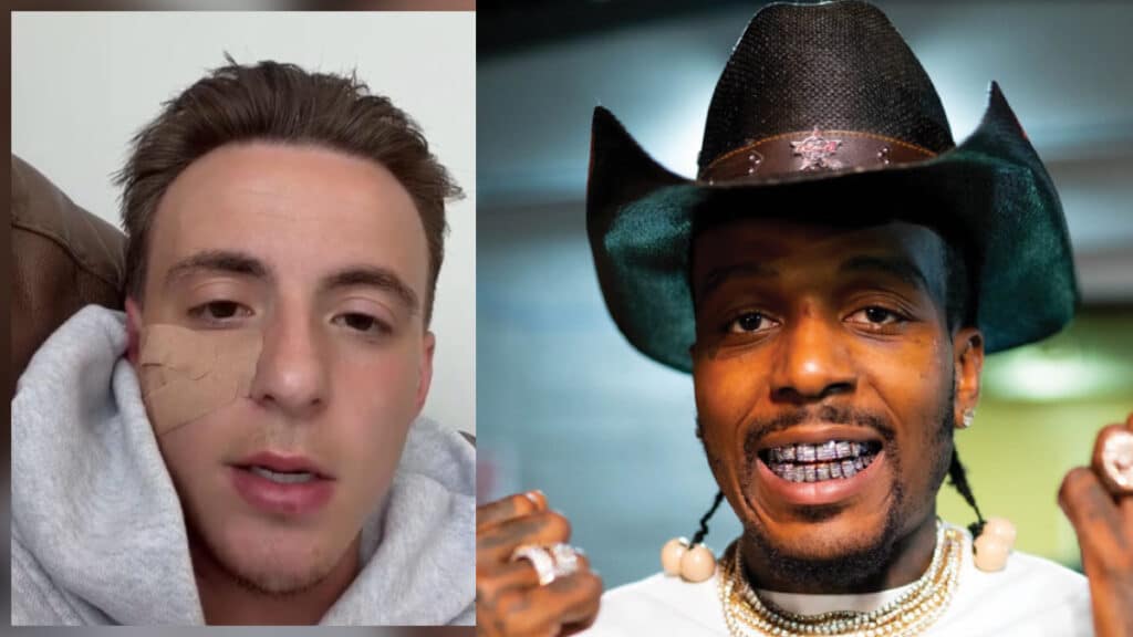 Raleigh Mobile Detailer Says He Was Gun-Whipped, Beat, & Robbed By Rapper Sauce Walka’s Crew