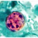 Microscopic view of Cyclospora cayetanensis oocysts, the parasite causing exploding diarrhea and cyclosporiasis outbreak in North Carolina
