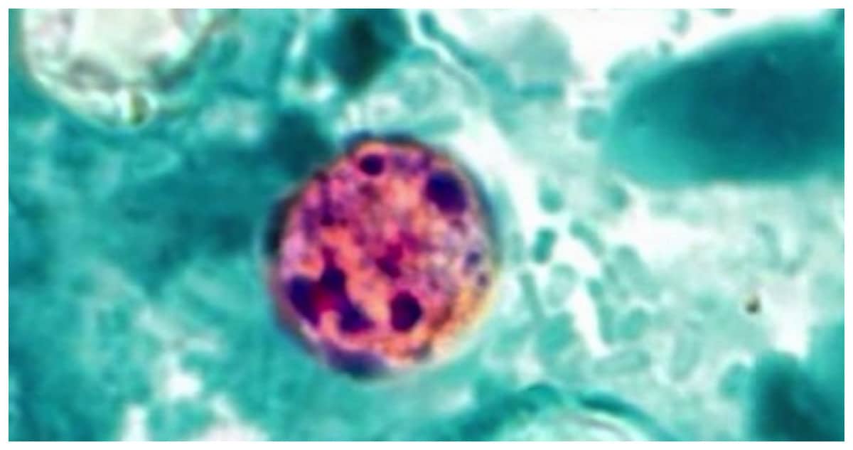 Microscopic view of Cyclospora cayetanensis oocysts, the parasite causing exploding diarrhea and cyclosporiasis outbreak in North Carolina